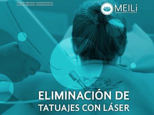 Eliminación de Tatuajes Con Láser ND-YANG picosegundos