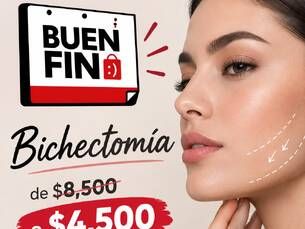 ¡Buen Fin! Bichectomia de $8,500 a $4,500.