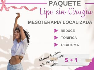 Lipo sin cirugía