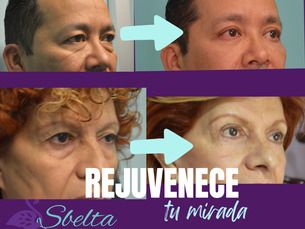 Rejuevenece tu mirada y luce menos cansada