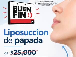 ¡Buen Fin! Lipopapada de $25,000 a $15,000.