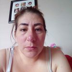 Anónimo