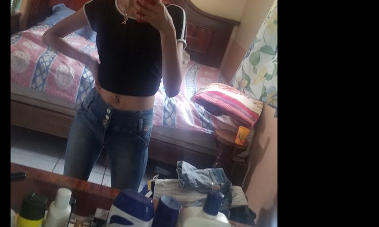 Cuanto debo pesar para una lipoescultura con transferencia a glúteos? - 6620