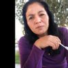 Además dLa toxina botulínica ¿existe algún tratamiento para parálisis facial?
