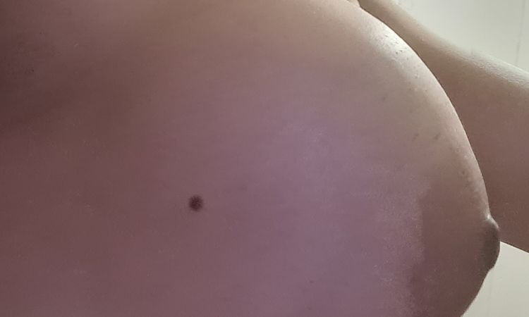Protesis altas, pezones mirando hacia bajo - 44025