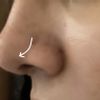 Rinoplastia tras 1 mes de cirugía ¿Inflamación o retracción?