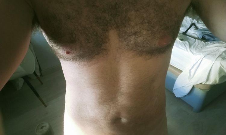 Depresiones con dolor y fibrosis tras liposucción abdominal - 55064