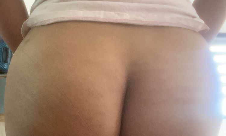 Modelar glúteos con lipotransferencia - 55087