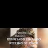 Peeling fenol para cicatrices de acné