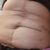 Mi abdomen tiene arreglo?