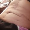 Mi abdomen tiene arreglo?