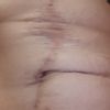 Mi abdomen tiene arreglo?