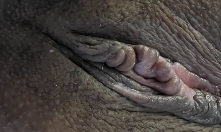 Tengo unos bultitos sobre el clitoris - 61143