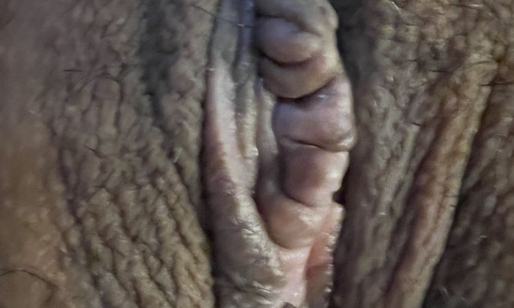 Tengo unos bultitos sobre el clitoris - 61144