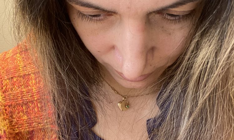 Nariz con deformidad, malposición de cartílagos alares - 63915