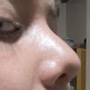 Mi nariz cambio de forma