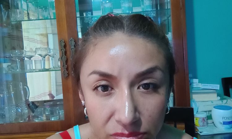 Inflamación tras rinoseptumplastia secundaria - 65918