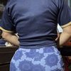 Cambios en glúteos porst lipoinyeccion