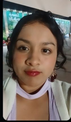 Bichectomía en jóvenes y hilos tensores - 82517