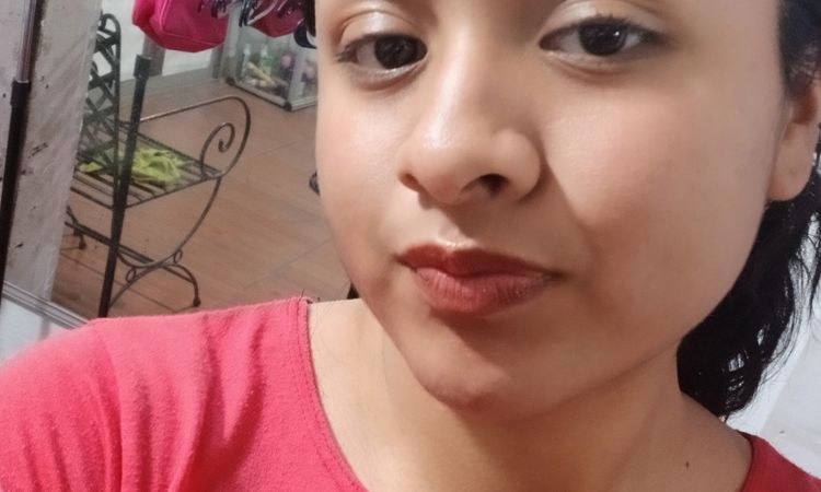 Bichectomía en jóvenes y hilos tensores - 82518