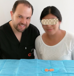 Postoperatorio de una bichetomía