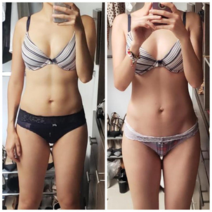 ¿Qué es la Radiofrecuencia?