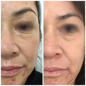 ¿Cómo encontrar al especialista adecuado para realizar el procedimiento?