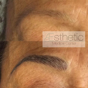 antes y después microblading