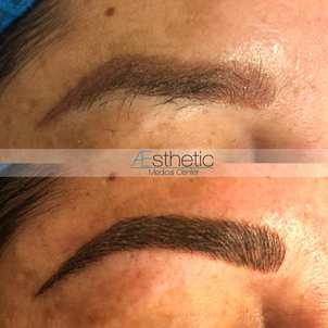 antes y después micropigmentación