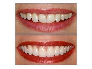 resultados ortodoncia