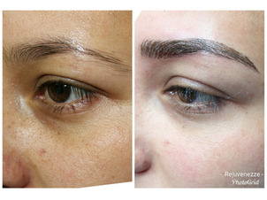 antes y después de microblading