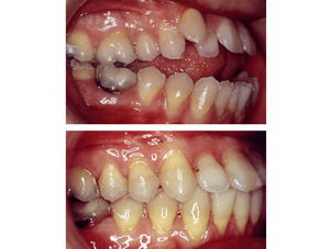 Cirugía maxilofacial