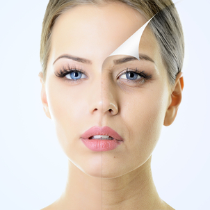 Tratamientos faciales signos de la edad