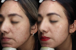 primera cita con el especialista