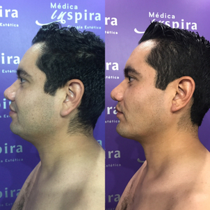 ¿Cómo es la primera visita con el cirujano?