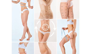 La grasa localizada se presentan en diferentes partes del cuerpo