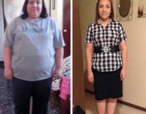 Resultados esperados de una manga gástrica