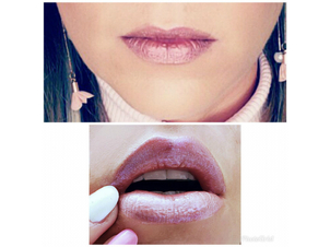 Antes y después aumento labios