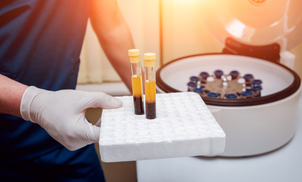 que es el plasma rico en plaquetas