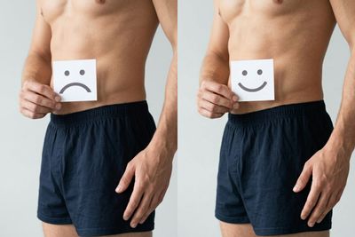 Antes y después de Blanqueamiento anal