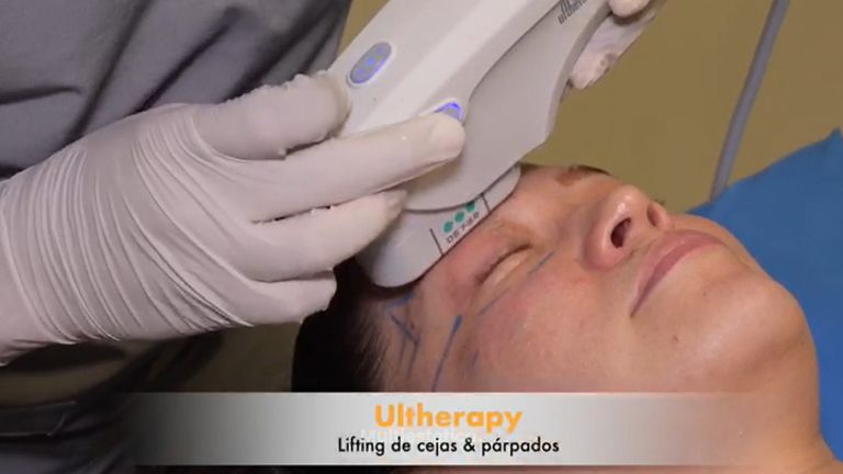 Lifting facial - Grupo Médico LIFE