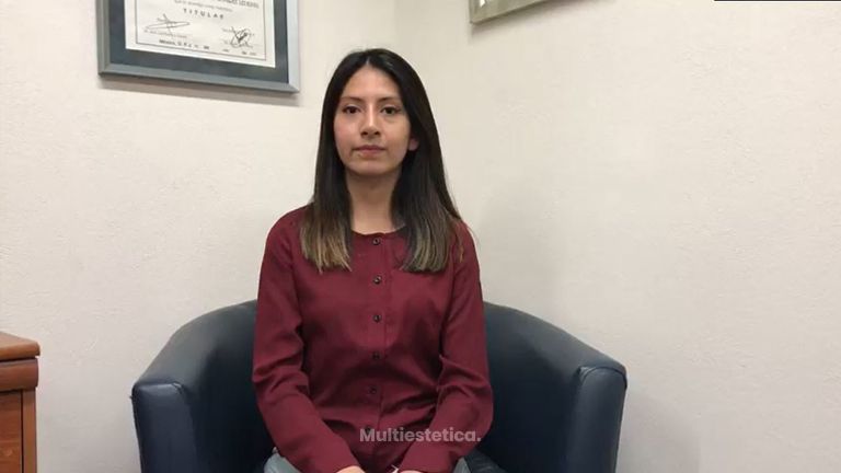 Testimonio Rinoplastia