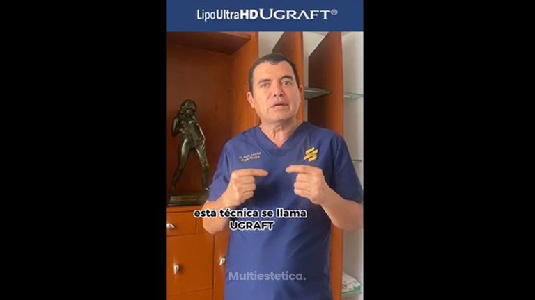 Liposucción - Dr. Xavier Sánchez García
