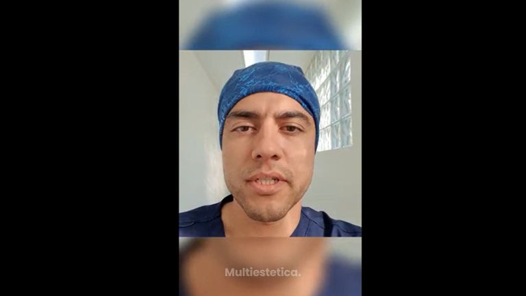 Resultado de Rinoplastia + Otoplastia - Dr. Gerardo Muñoz Jiménez