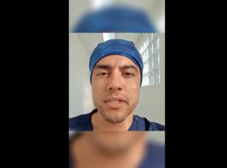 Resultado de Rinoplastia + Otoplastia - Dr. Gerardo Muñoz Jiménez