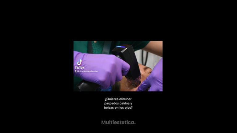 Blefaroplastia - Dra. Carmen Damián
