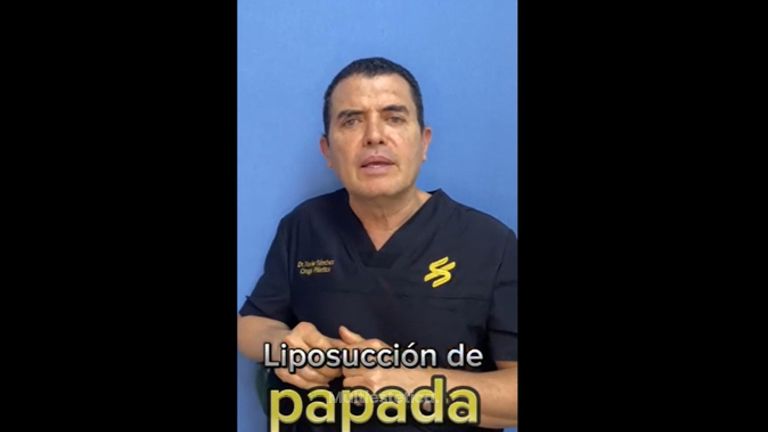 Cirugía de papada - Dr. Xavier Sánchez García