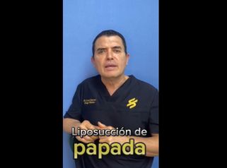 Cirugía de papada - Dr. Xavier Sánchez García