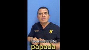 Cirugía de papada - Dr. Xavier Sánchez García