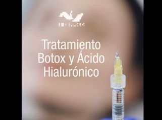 Toxina botulínica y Ácido hialurónico